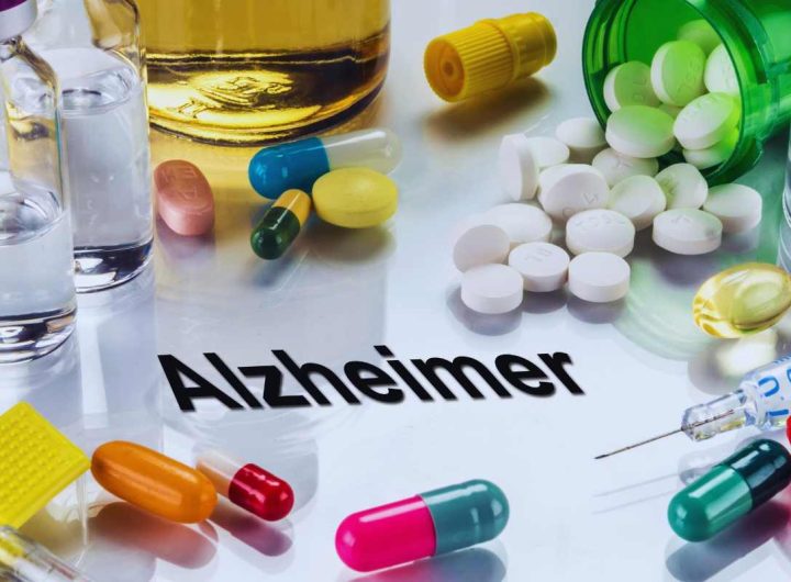 i primi sintomi dell'Alzheimer